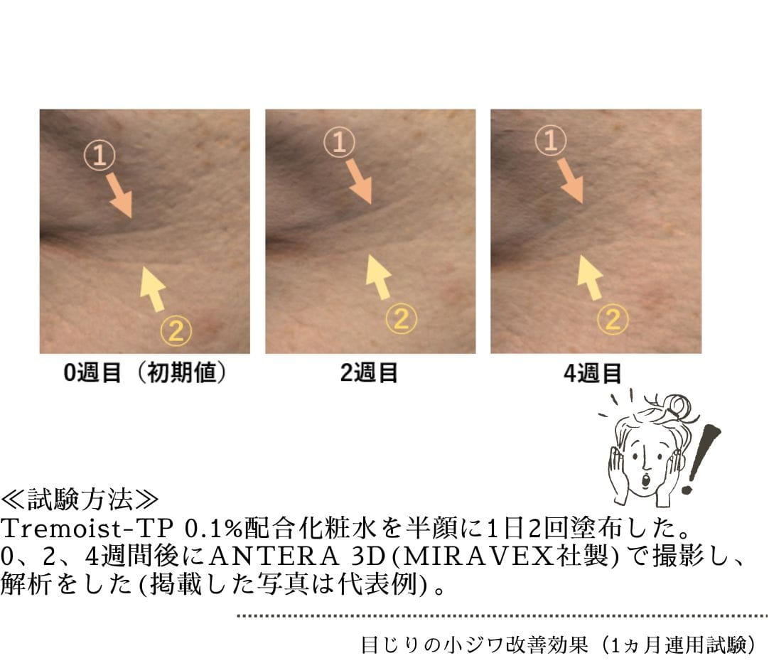 アンチポリューション効果 細胞内ROS